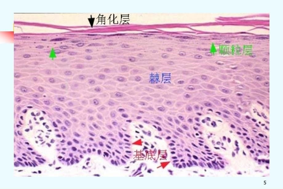 口腔粘膜组织病理_第5页