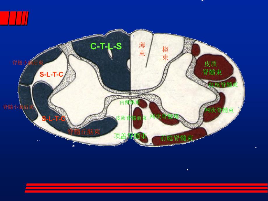 椎管内肿瘤魏_第4页