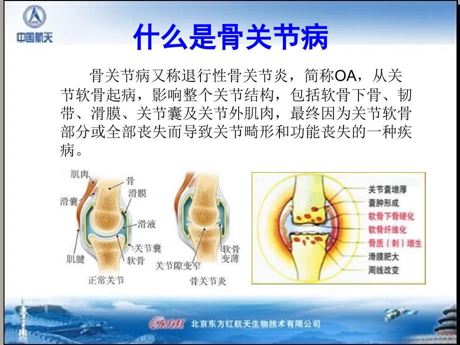 氨糖与骨关节病_第2页