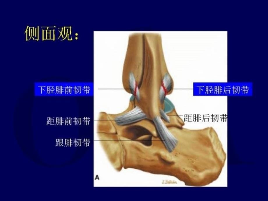 下胫腓联合损伤_第5页