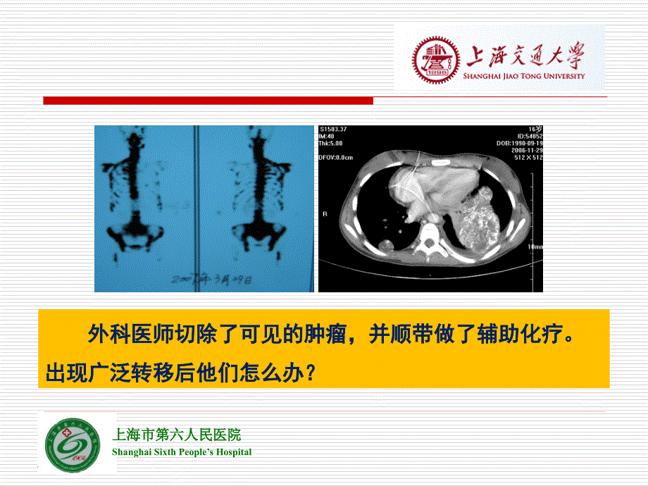 上海交通大学软组织肿瘤_第4页