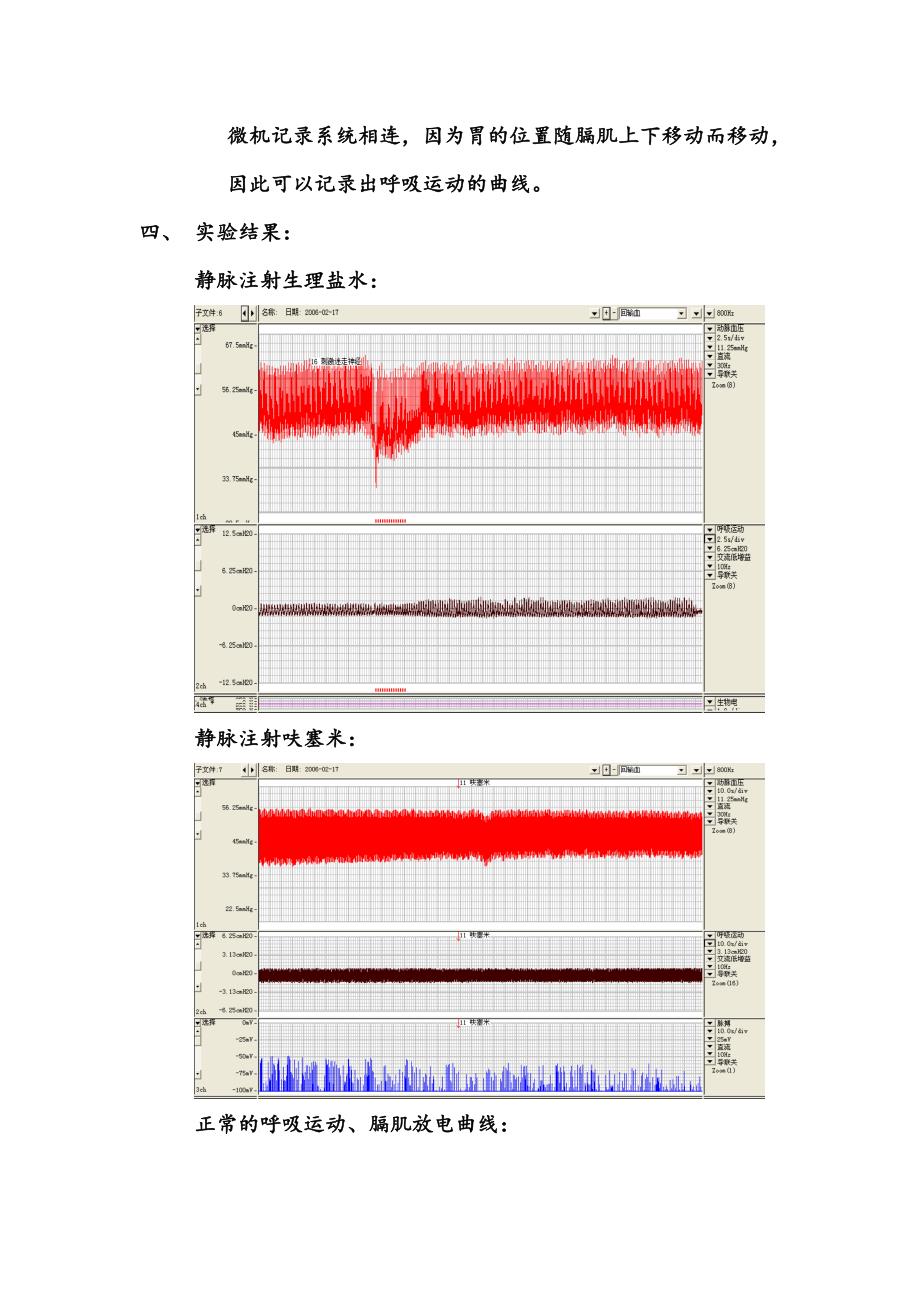 影响尿液生成的因素、呼吸运动的调节_第2页