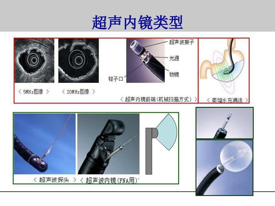 超声内镜在消化疾病中的临床应用2015_第5页