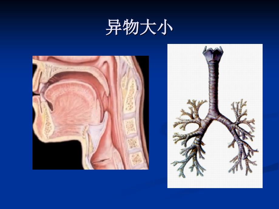 支气管异物-于磊_第4页