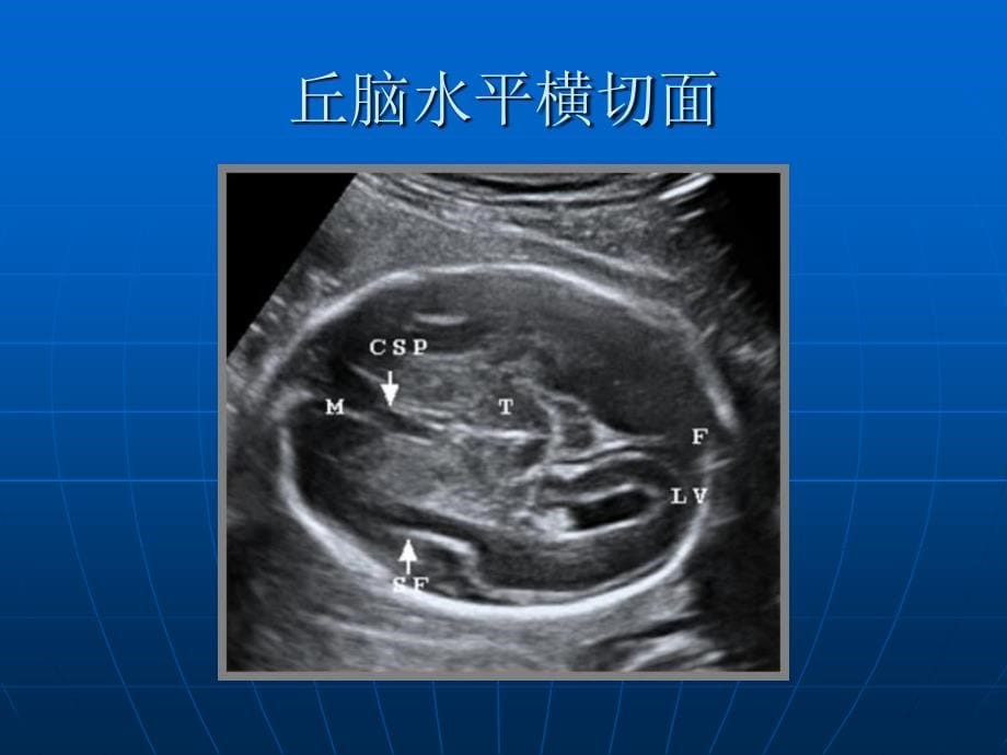 晚期妊娠胎儿超声解剖湖南中医药大学_第5页