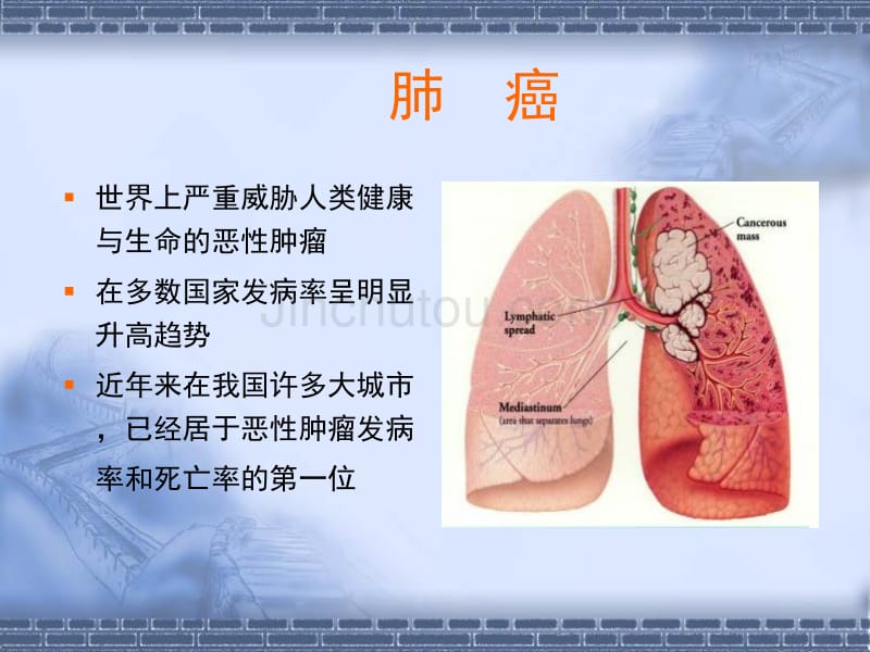 非小细胞肺癌的规范化治疗及进展S_第2页