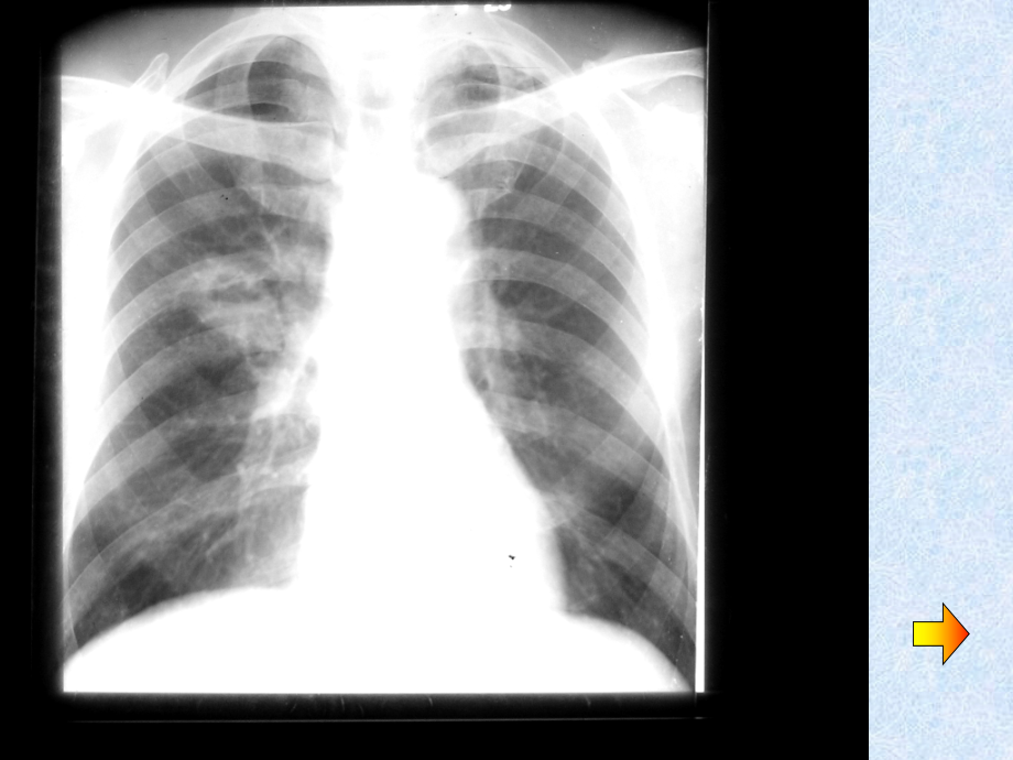 医学生临床技能考核X线读片部分_第4页