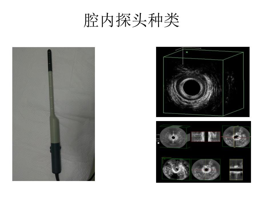 直肠腔内超声的临床诊断林鸿_第4页