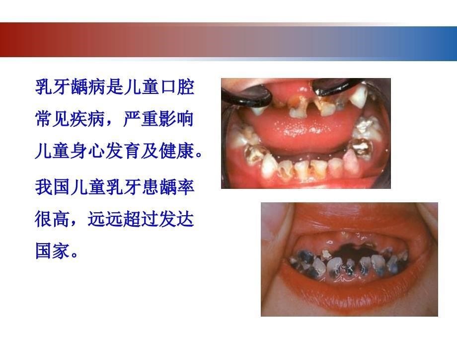 清华大学答辩2012531_第5页