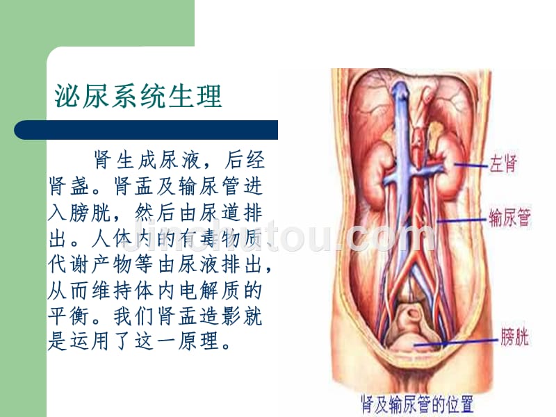 IVU静脉肾盂输尿管造影技术_第5页