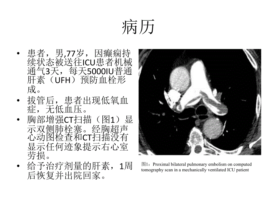 ICU静脉血栓栓塞2015年综述_第3页