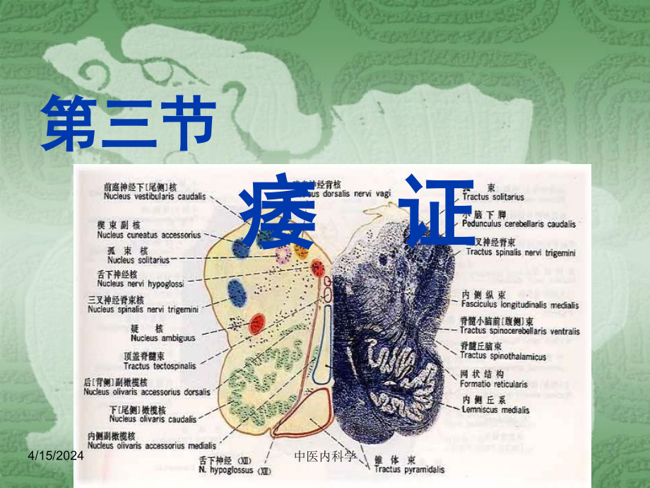 中医内科学课件3痿证_第1页