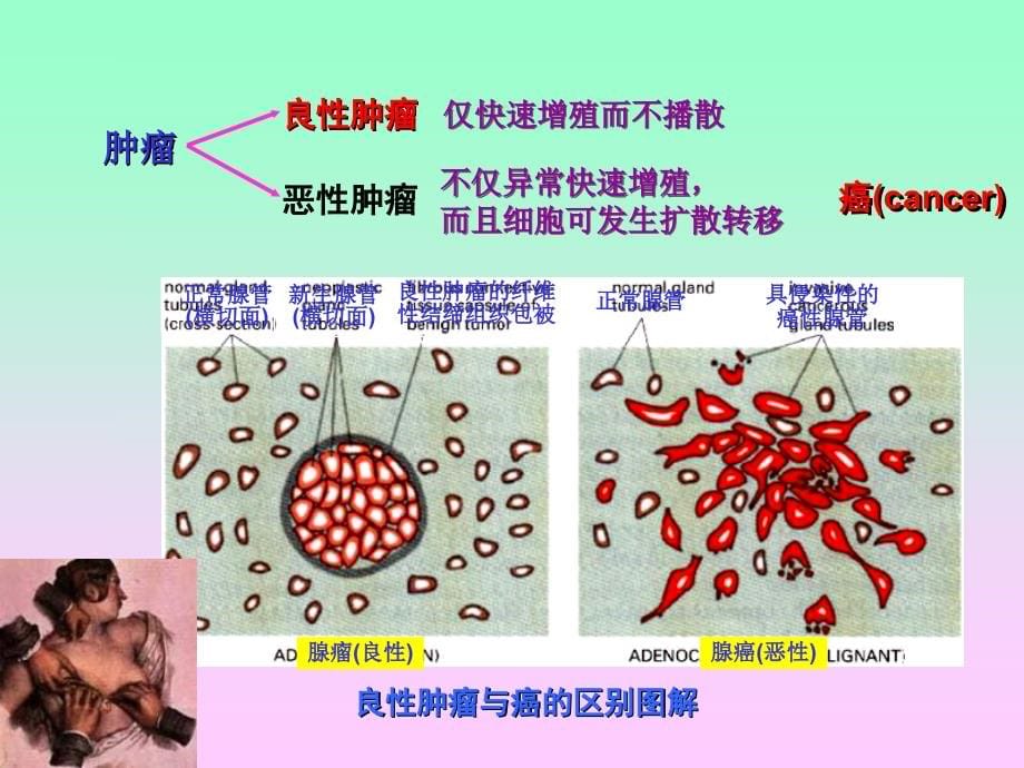 中国海洋大学细胞生物课件19癌细胞与癌基因_第5页