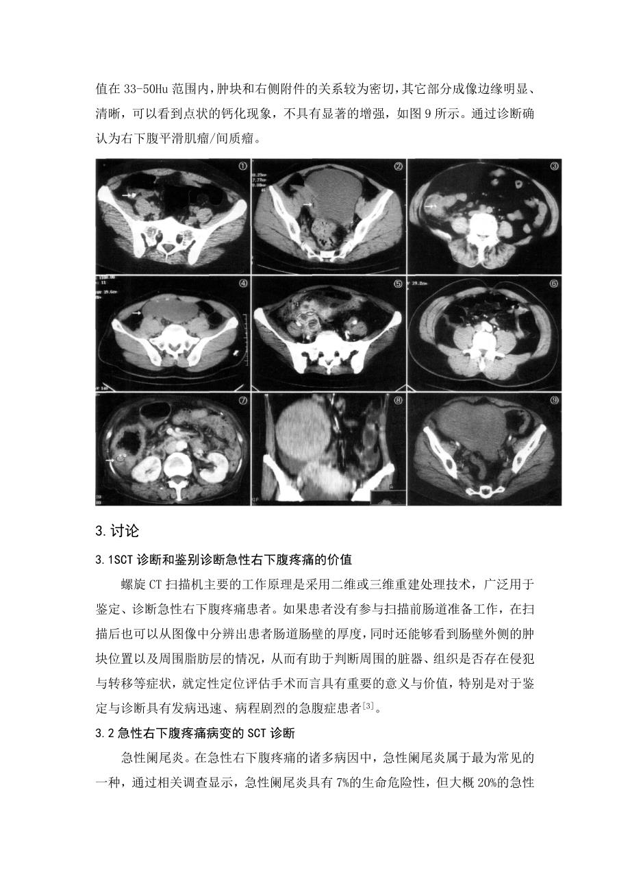 对于螺旋CT诊断和鉴别诊断急性右下腹疼痛的价值分析_第3页