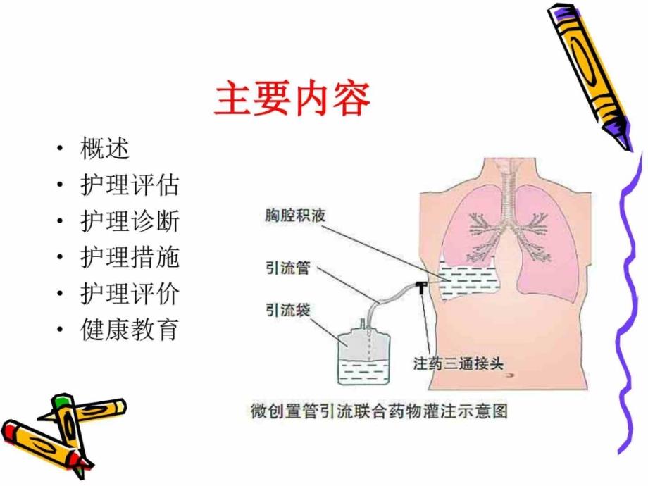 胸腔积液护理查房_图文_第2页