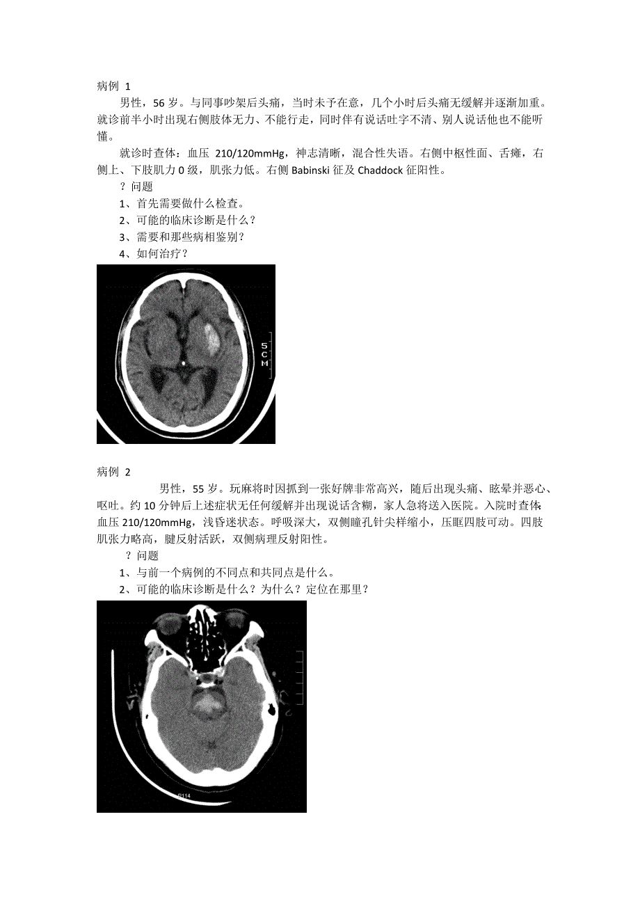 内科组病例讨论第9场 神经内科病例 2_第1页