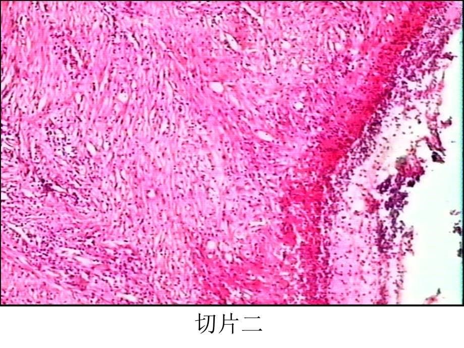 病理实验3-2_第5页