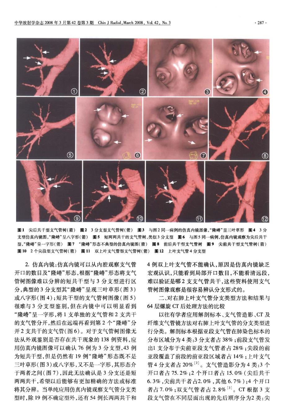 右肺上叶支气管解剖_第3页