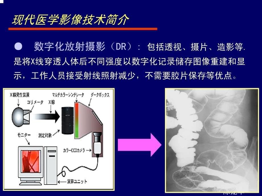 肿瘤影像与放射治疗_第5页