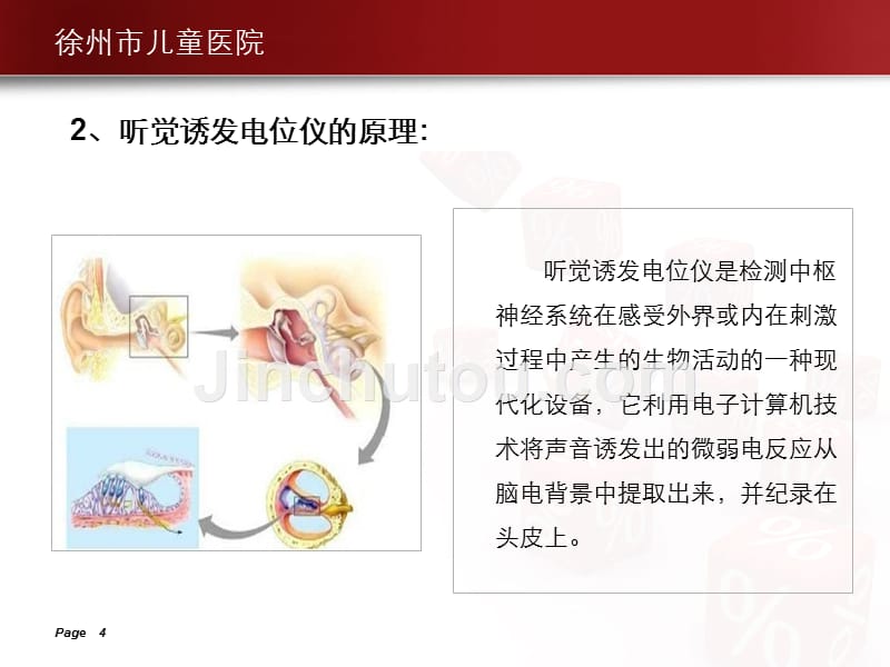 脑干诱发电位—刘军_第4页