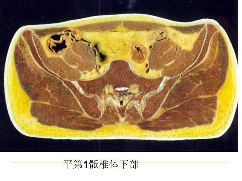 男性盆部和会阴断层解剖_第5页