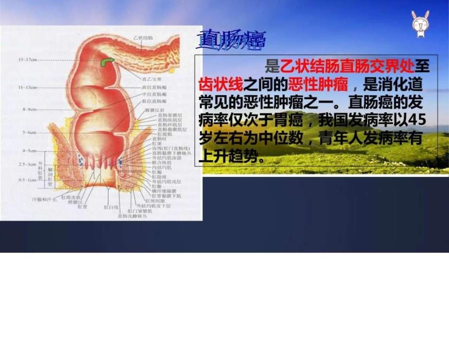 直肠癌伴多发转移的护理查房_图文_第4页