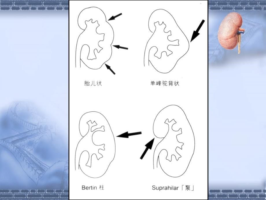 肾脏病基础知识_第5页