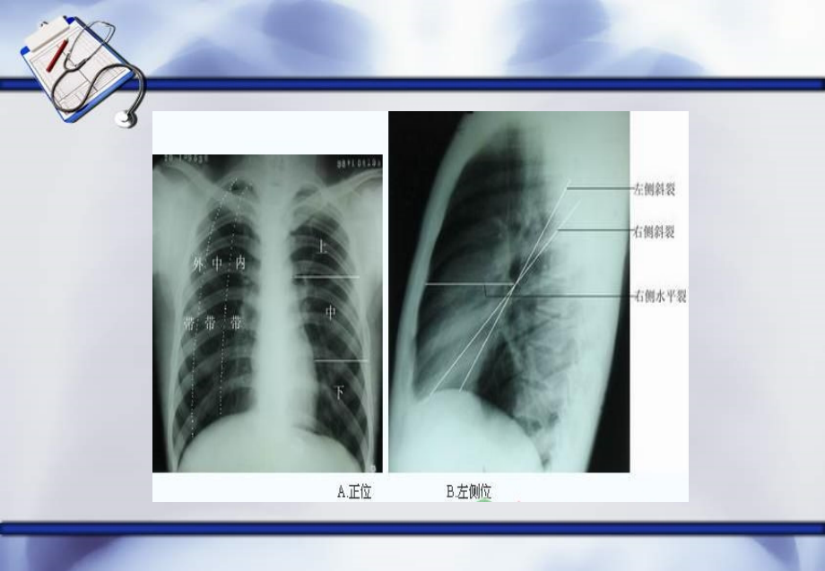 呼吸系统疾病临床医学概论课件_第4页