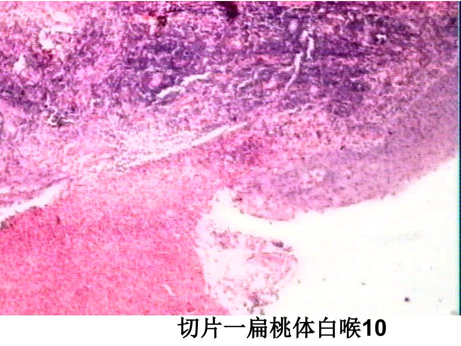 病理实验5-2_第2页