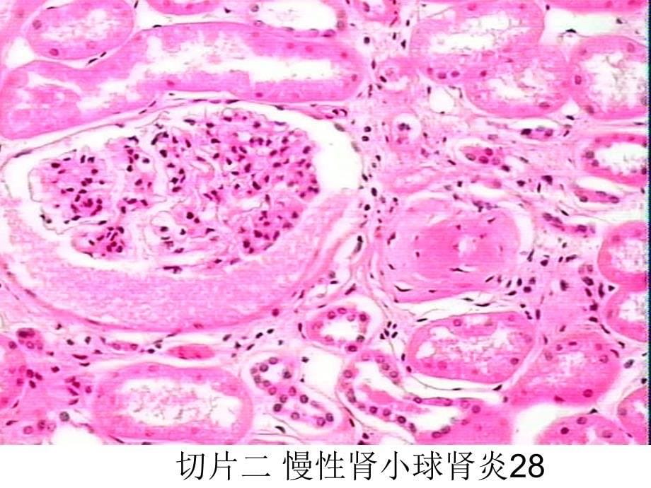 病理实验5-2_第5页