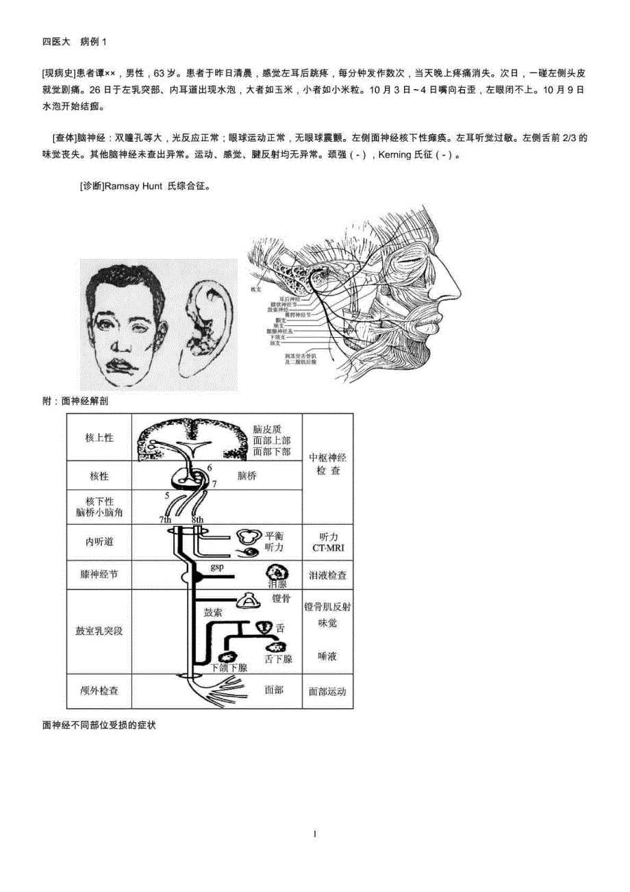 神经内科病例分析研究_第1页
