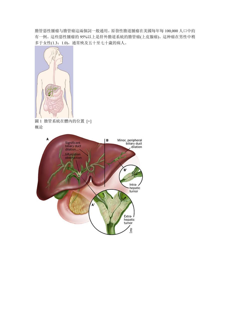 胆管癌精美图解_第1页