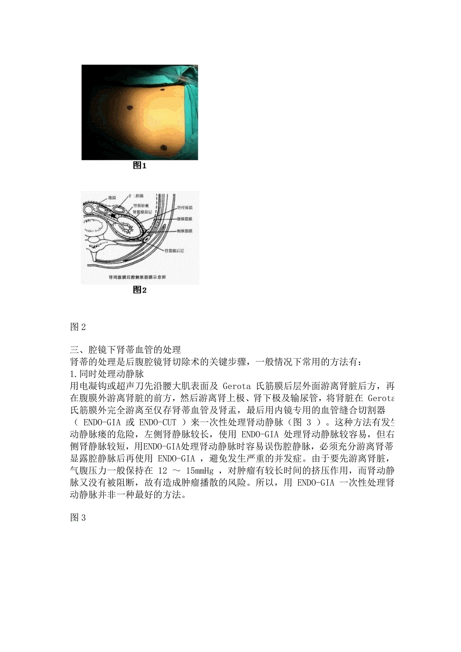 肾蒂及腹腔后间隙解剖特征_第2页