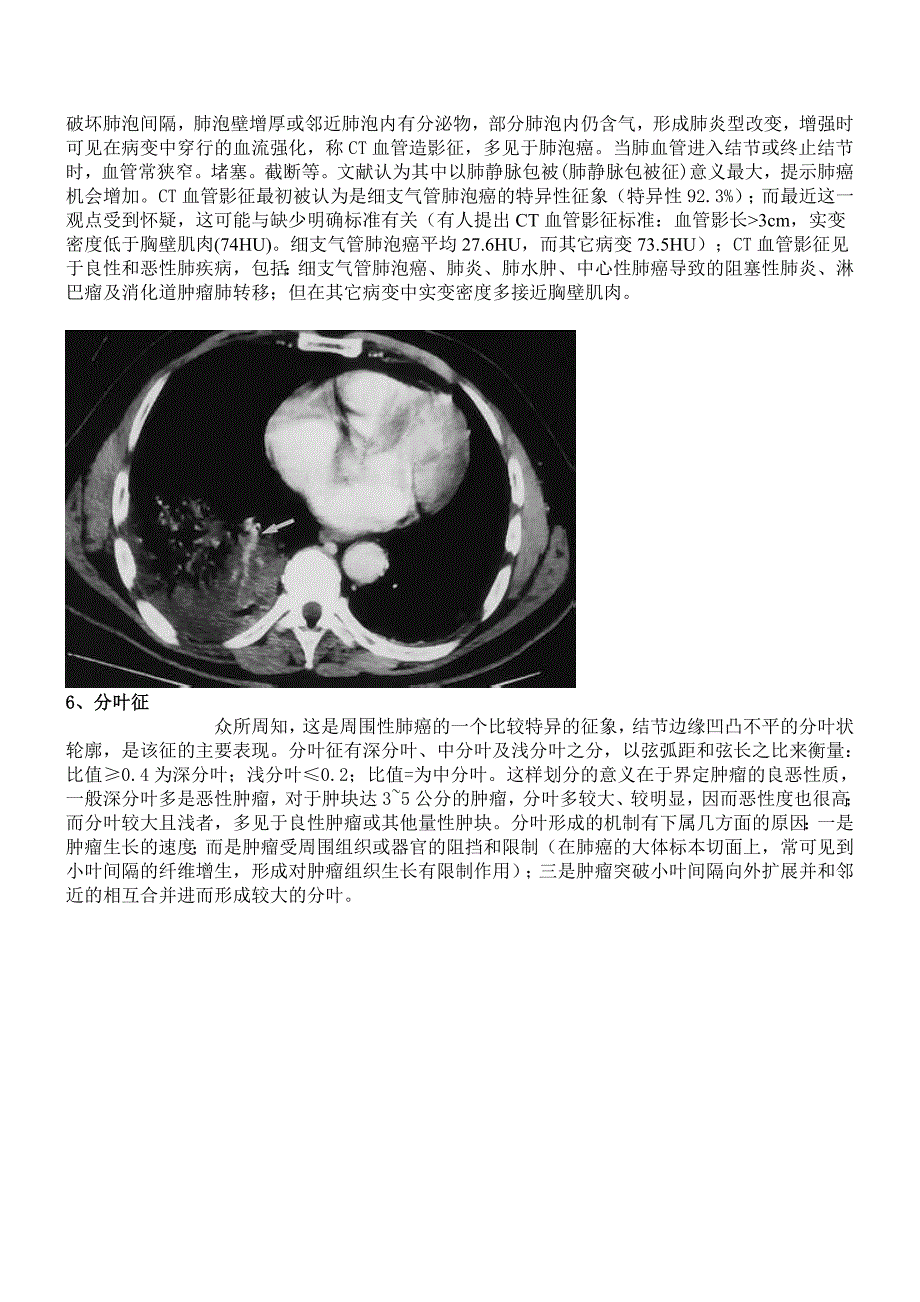 胸部医学影像征象集萃_第4页