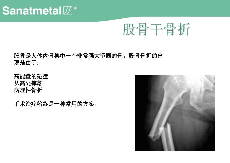 新股骨髓内钉培训课件_第2页