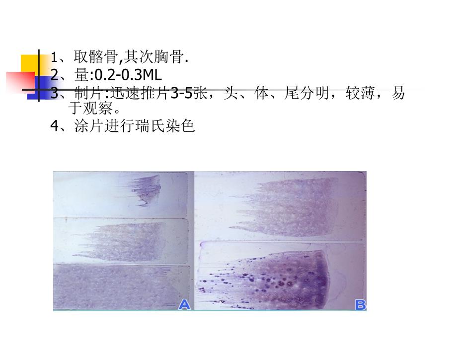 正常骨髓形态学检查_第3页