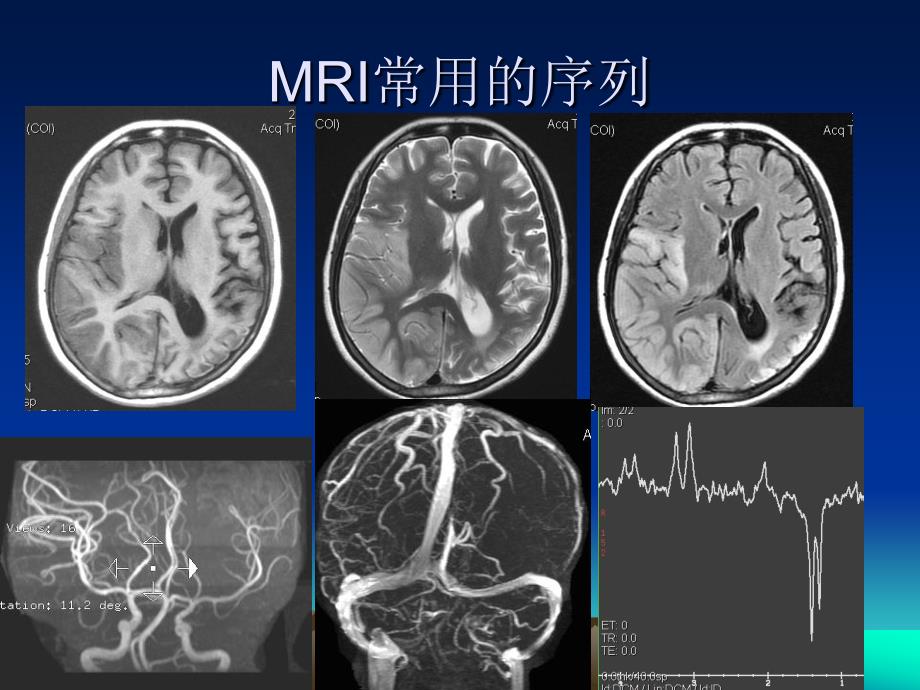 头颅MRI断层解剖_第2页