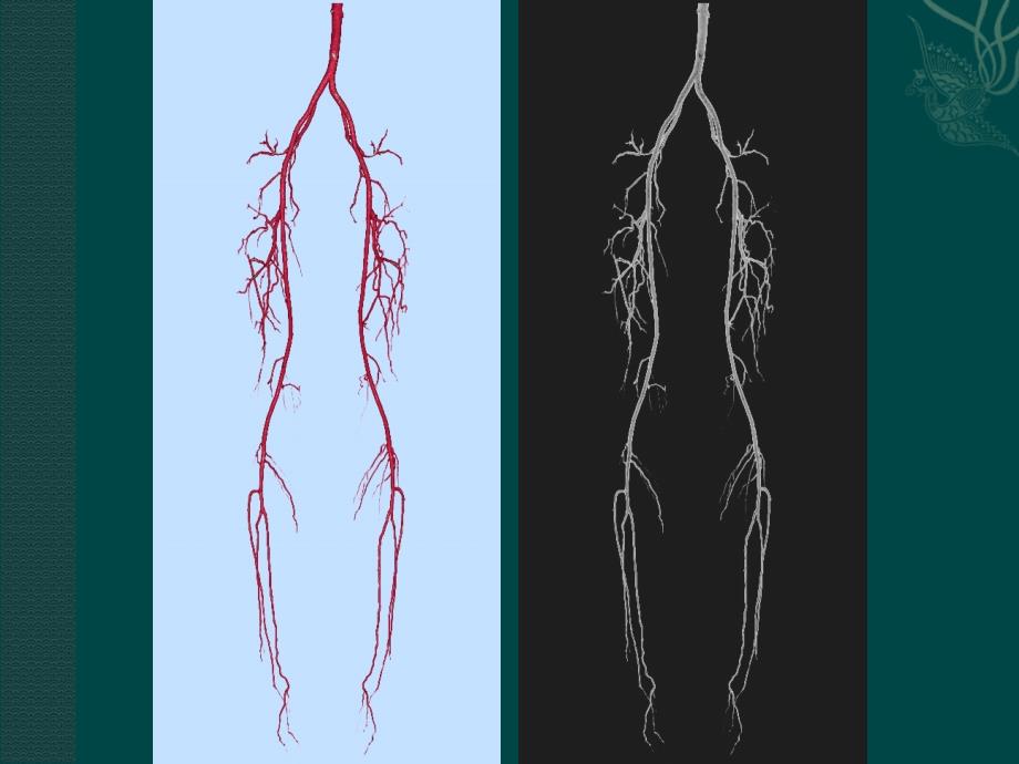 双下肢动脉解剖_第4页