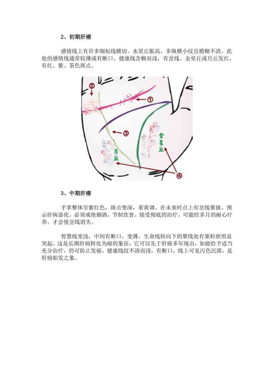 24种手相揭示身心健康问题_第2页