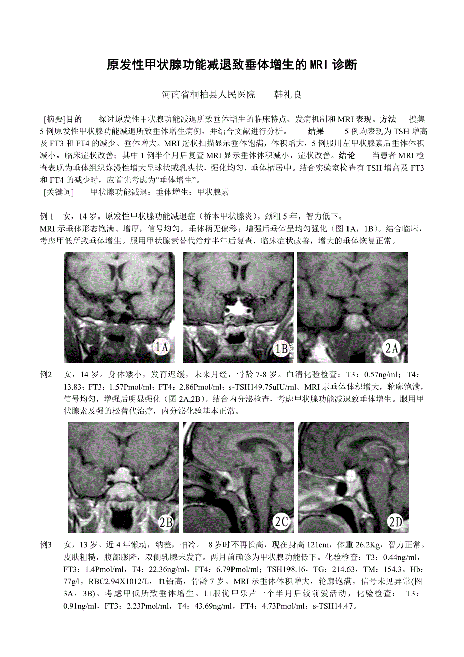 原发性甲状腺功能减退致垂体增生的MRI诊断_第1页