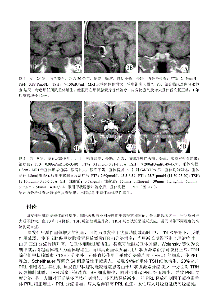 原发性甲状腺功能减退致垂体增生的MRI诊断_第2页