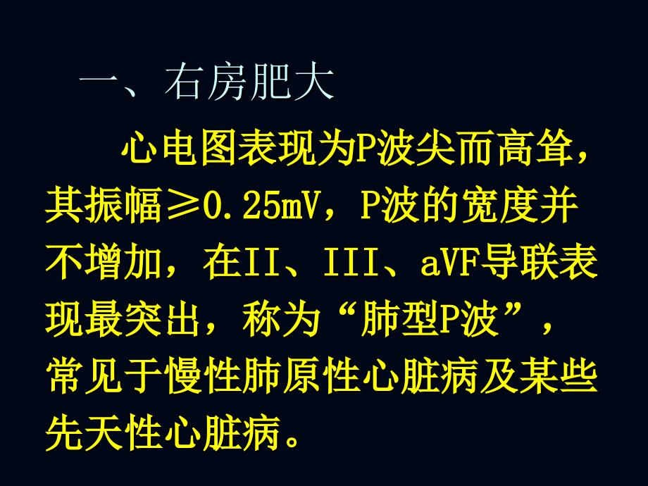 心电图诊断--心房、心室肥大缺血症课件_第2页