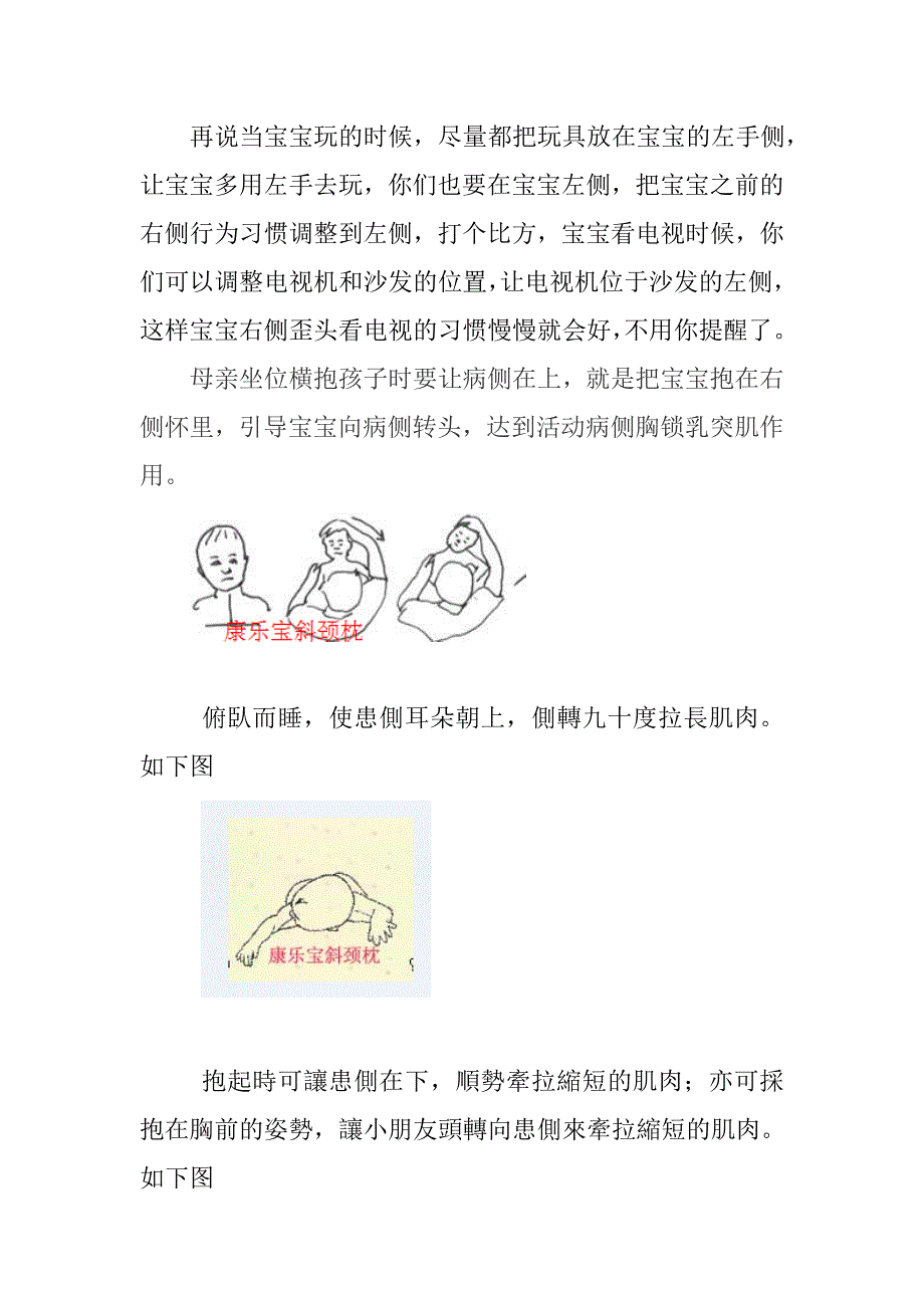 宝宝右侧斜颈的康复方案_第2页