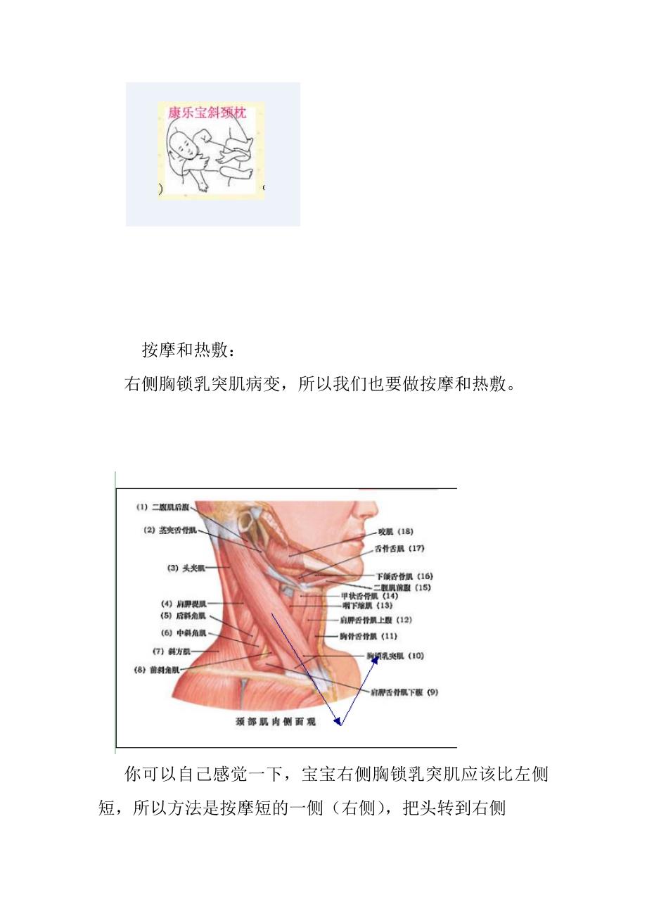 宝宝右侧斜颈的康复方案_第3页