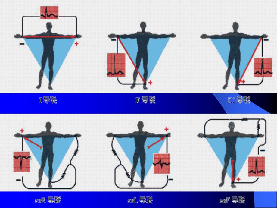 简要分析和判读心电图课件_第3页