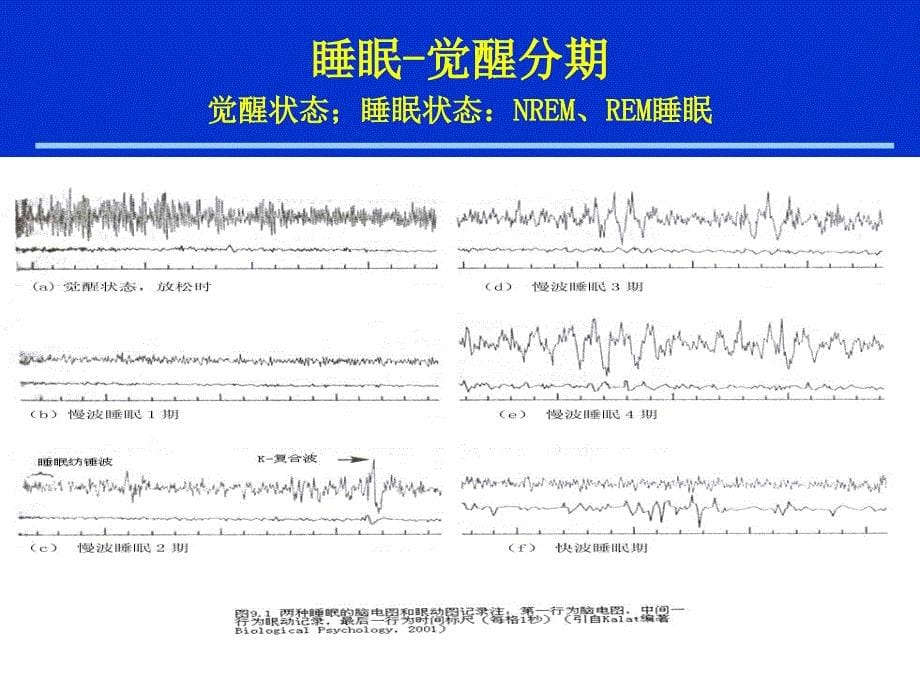 慢性失眠的诊断和治疗课件_第5页