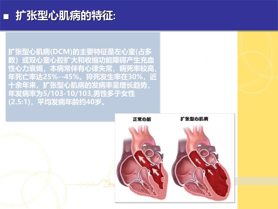 扩张型心肌病的治疗与护理_第2页