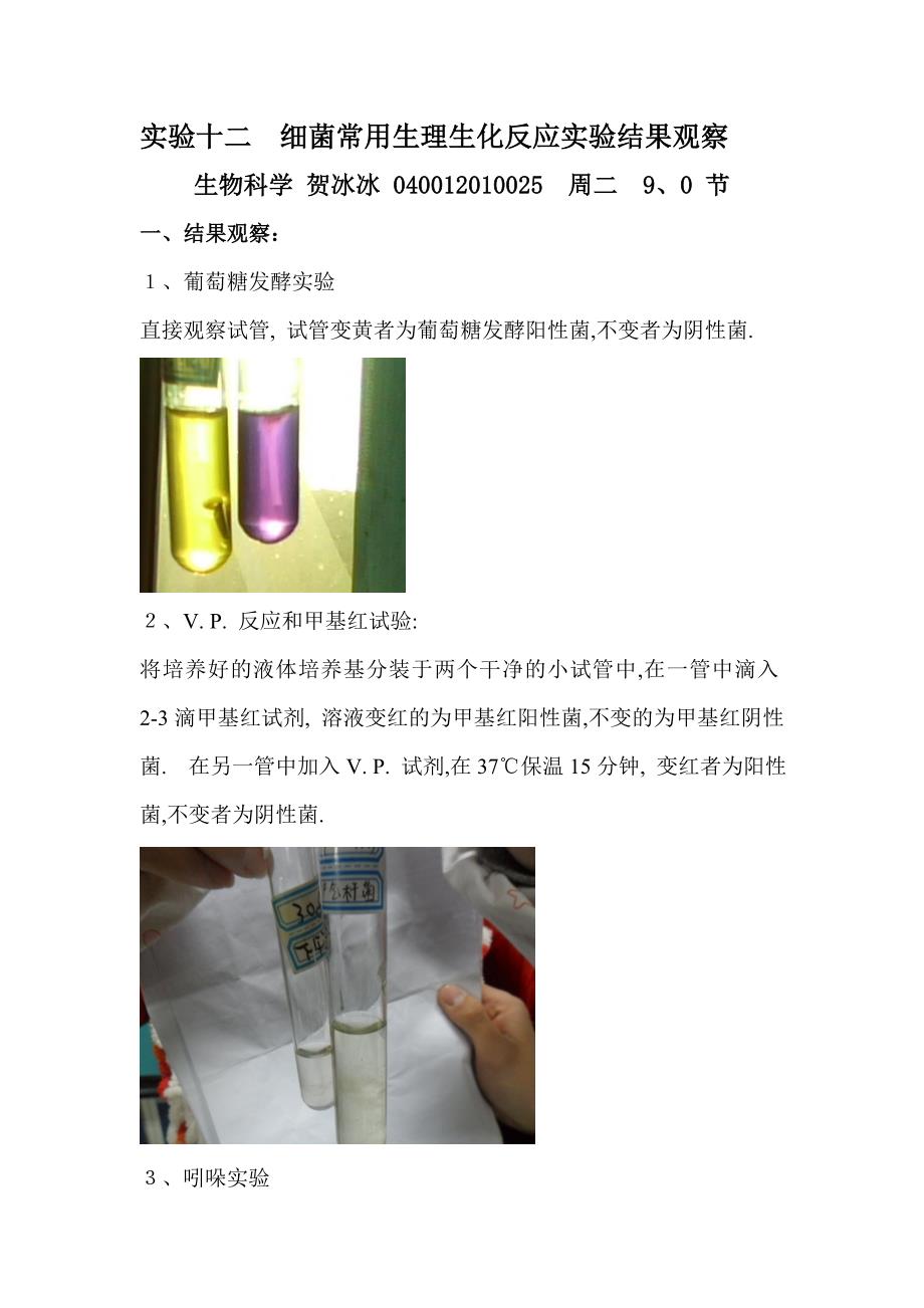 实验十二 细菌常用生理生化反应实验结果观察_第1页