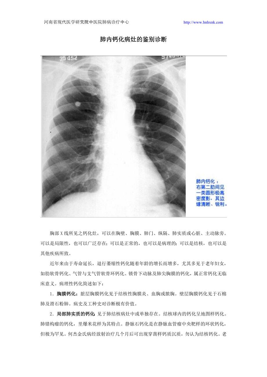 肺内钙化病灶的鉴别诊断_第1页