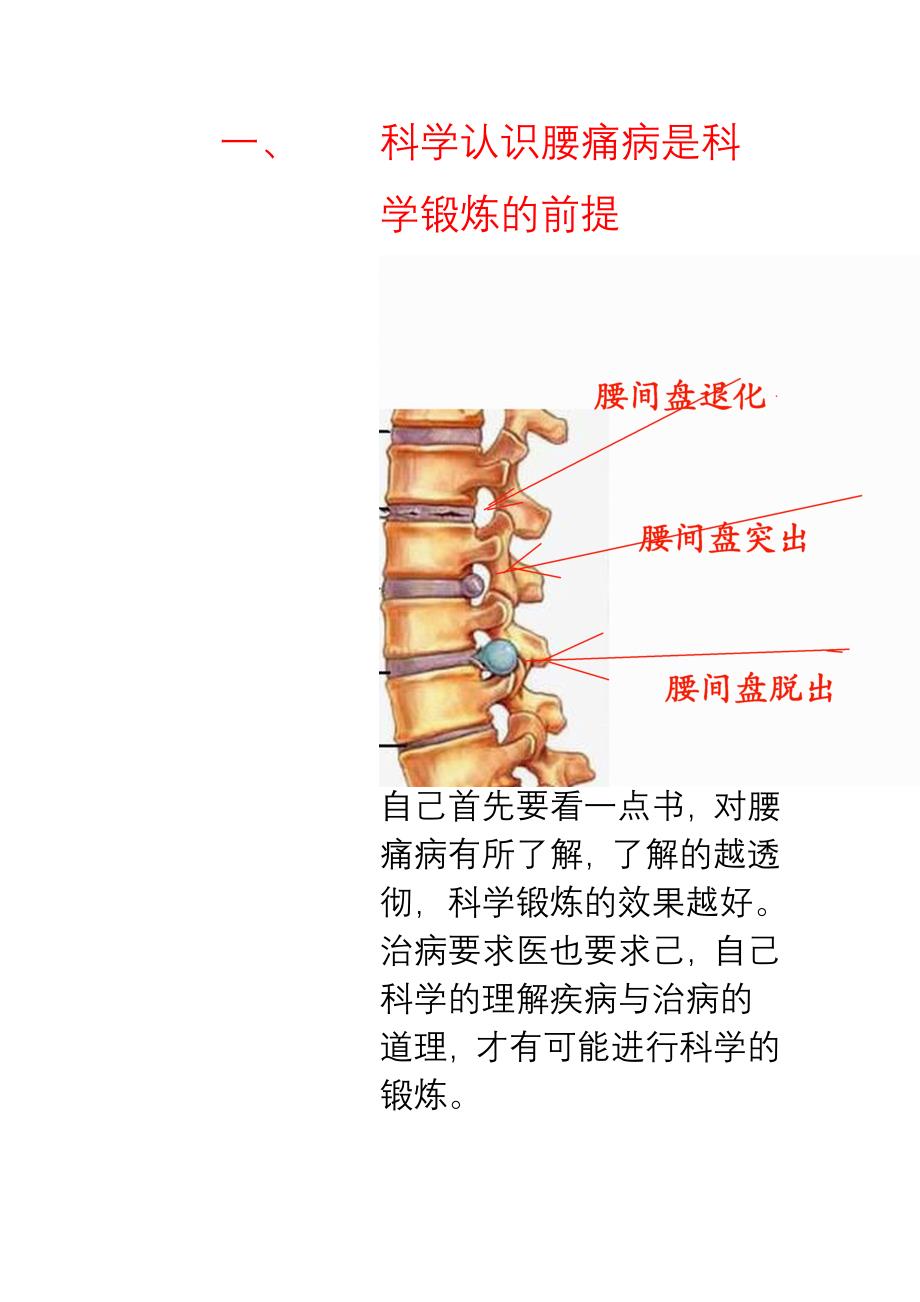 腰痛病的科学锻炼康复_第2页